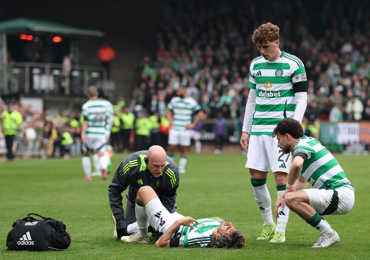 Jota of Celtic receives treatment